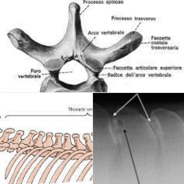 lesioni